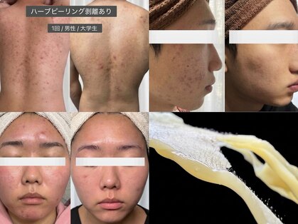 ステラ(Stella)の写真