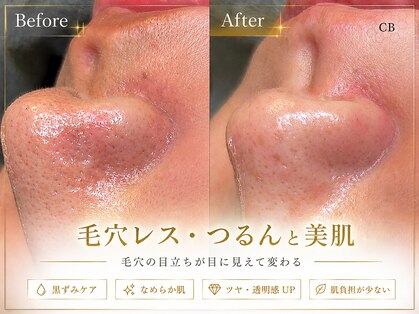 クリスタルビューティ 渋谷の写真