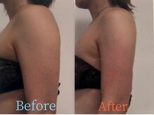 ガネェーシャ(Ganesha)/二の腕すっきりサーモシェイプ