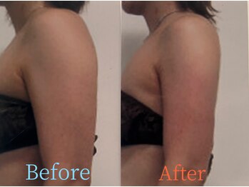 ガネェーシャ(Ganesha)/二の腕すっきりサーモシェイプ