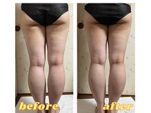 ラレコルト/ビフォーアフター