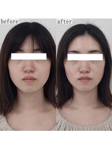 ヴェルシック(Belchic)/むくみやすい方から大人気