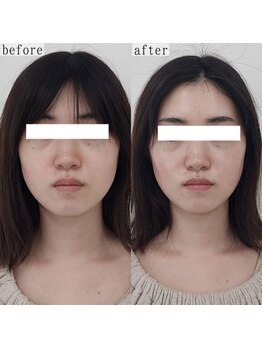 ヴェルシック(Belchic)/むくみやすい方から大人気