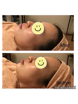 フェリース鍼灸院/