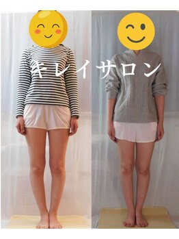 東金ひまわり美容整体サロン/