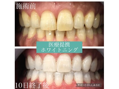 シャイニー(Shiny)の写真