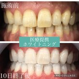 シャイニー(Shiny)