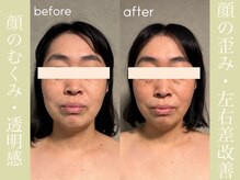 健志接骨院/πテラピー造顔メソッド