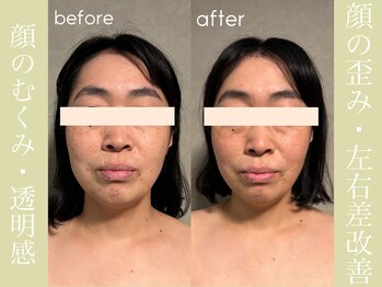 健志接骨院/πテラピー造顔メソッド