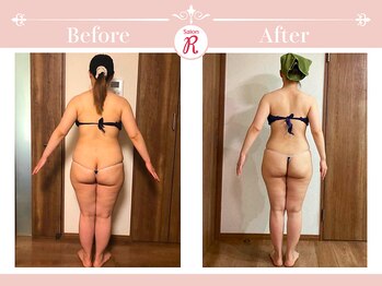 サロン アール(Salon R)/痩身施術×食事・インナーケア
