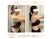 ヨサパーク ミッカ 学芸大学(YOSA PARK MiCCA.)の雰囲気（体脂肪平均２％落ちる！ぽっこりお腹・背肉・太もも脂肪撃退！！）