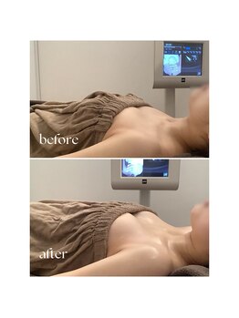 ボーレーヴ 表参道店(beaureve)/インディババストアップ