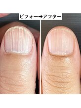 桃の木 吉祥寺店/縦筋は時間がかかります