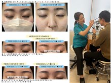 エチ毛ットの雰囲気（ワックスとは違う卒業できる眉毛脱毛はデザインからしっかり提案）