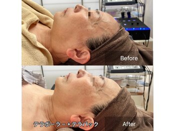 アオダモ(aodamo)/