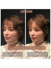 サリエ(S'allier)/お客様のビフォーアフター