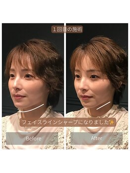 サリエ(S'allier)/お客様のビフォーアフター