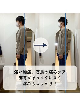 なぎのき鍼灸治療院/強い腰痛・肩こり・首の痛みケア