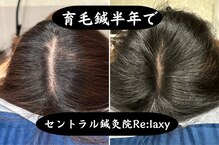 セントラル鍼灸院リラクシー(Re:laxy)