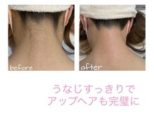 サロン ド モモ(salon de momo)/うなじデザインwax脱毛
