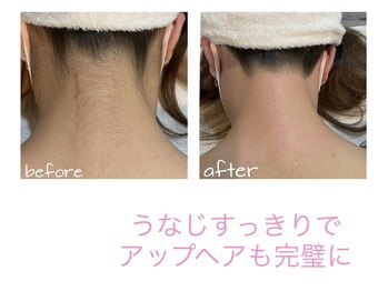 サロン ド モモ(salon de momo)/うなじデザインwax脱毛