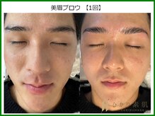 ひかり素肌/美眉ブロウ1回