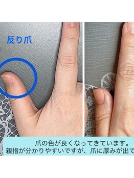 桃の木 吉祥寺店/反り爪も時間がかかります