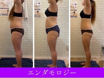 オーシャンブルー 大分店(OCEAN BLUE)/エンダモロジー