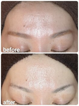 ウララ(ulala)/セラピール1回目