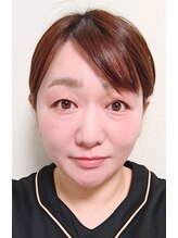 美肌プロジェクト カーラ 東川口店(CARA) 江川