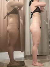 ビューティーサロン アンジェリーク/ボディ　before→after