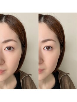 イチ(ichi)/まつげパーマ