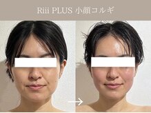 リィ プラス(Riii plus)/Riii plus式　小顔コルギ