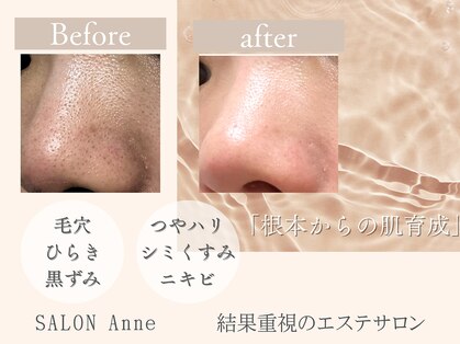 サロン アンネ(Anne)の写真