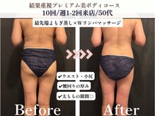 ヨサパーク 杣(YOSA PARK)/ルルオン10回の効果