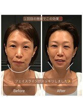 サリエ(S'allier)/お客様のビフォーアフター