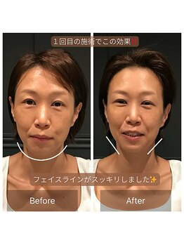 サリエ(S'allier)/お客様のビフォーアフター