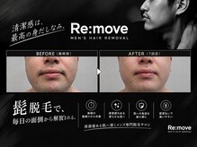 リムーブ(Re:move)