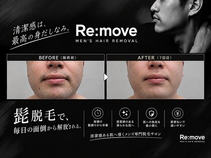 リムーブ(Re:move)の写真