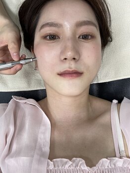 シンメトリー 熊本/痛みが少ないので寝てしまう方も