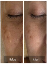 ヴィオラス(VIOLUS)/