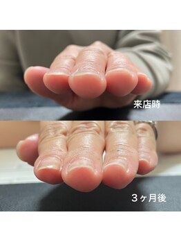 プルームネイル(plume.nail)/自爪育成