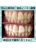 【平日1名様限定】1day集中ホワイトニング　50分照射(25分×2回) 何度でもOK!