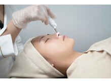 フェリス(feliz)/～当日の流れ～シミケア