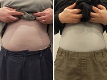 ベリッセ(Belisse)/ボディスカルプト【痩身】１０回