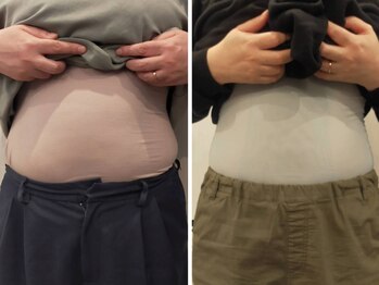 ベリッセ(Belisse)/ボディスカルプト【痩身】10回