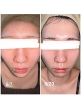 ミニョン(mignon)/モニター結果