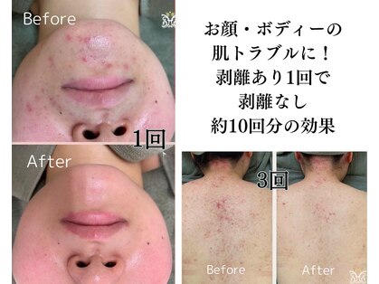 ダイヤモンド リーエンダ(Diamond leende)の写真
