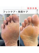 ピーアンドオー(P&O)/