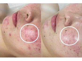 アンリミット 渋谷宮益坂店(Une limit)/【繰り返すトラブル】